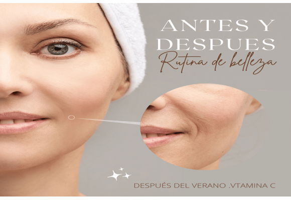 TRATAMIENTO PIELES SECAS Y CASTIGADAS EN VERANO